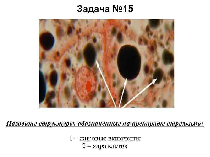 Задача № 15 Назовите структуры, обозначенные на препарате стрелками: 1 – жировые включения 2