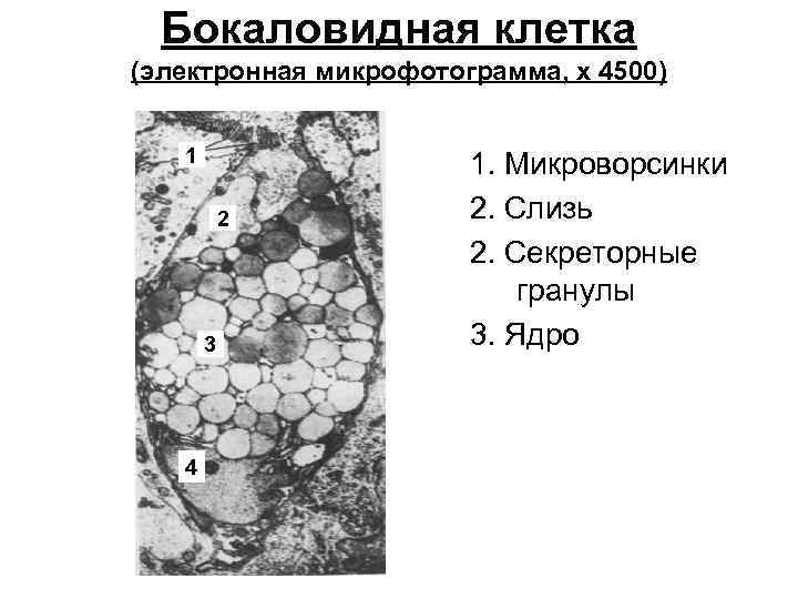 Бокаловидные клетки. Строение и функции бокаловидной клетки. Строение бокаловидной клетки. Бокаловидная клетка Электронограмма. Ядро бокаловидной клетки.