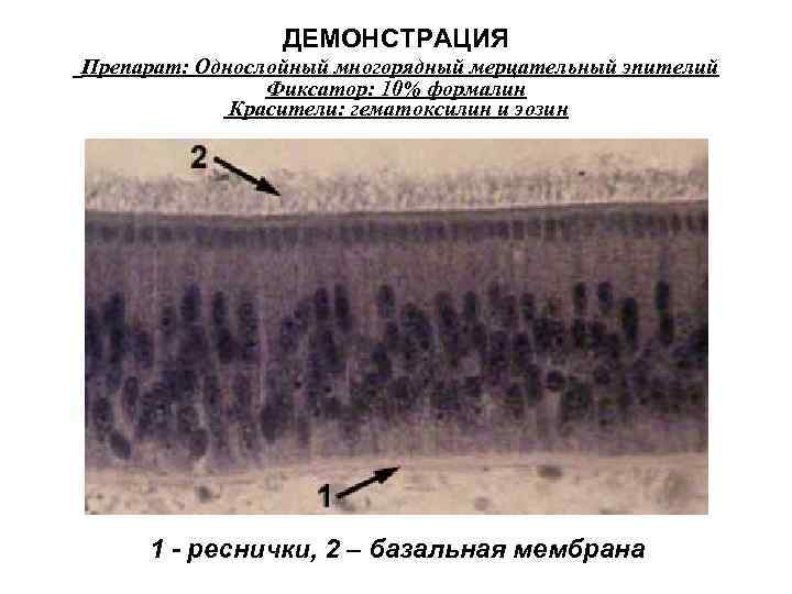 ДЕМОНСТРАЦИЯ Препарат: Однослойный многорядный мерцательный эпителий Фиксатор: 10% формалин Красители: гематоксилин и эозин 1