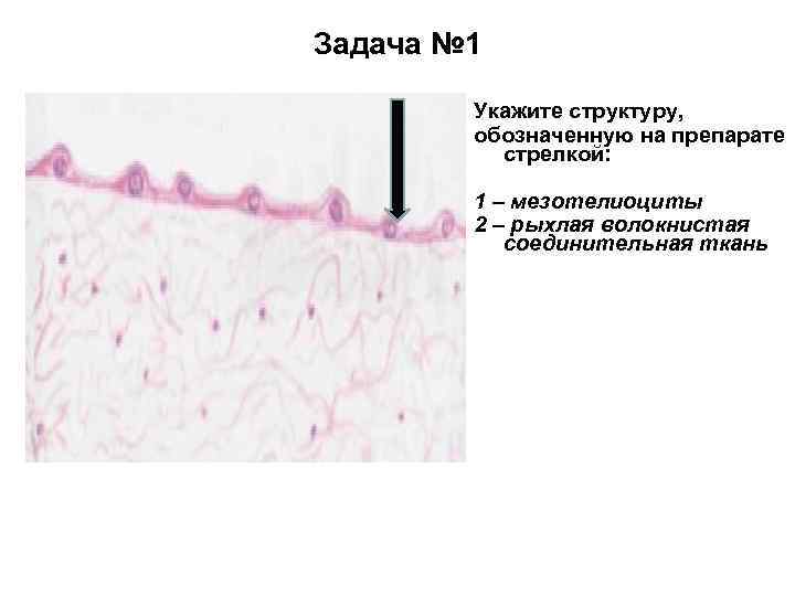 Задача № 1 Укажите структуру, обозначенную на препарате стрелкой: 1 – мезотелиоциты 2 –