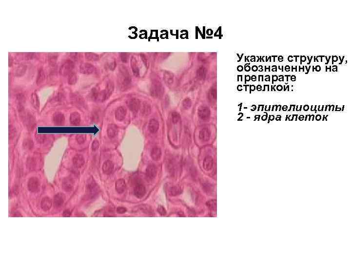 Задача № 4 Укажите структуру, обозначенную на препарате стрелкой: 1 - эпителиоциты 2 -