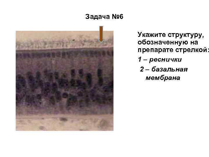 Задача № 6 Укажите структуру, обозначенную на препарате стрелкой: 1 – реснички 2 –