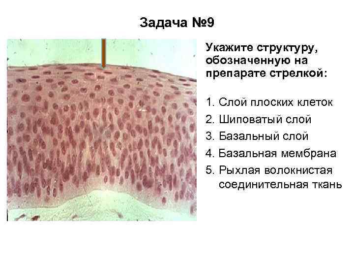 Задача № 9 Укажите структуру, обозначенную на препарате стрелкой: 1. Слой плоских клеток 2.