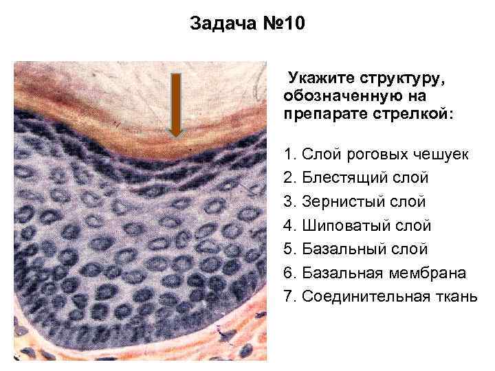 Задача № 10 Укажите структуру, обозначенную на препарате стрелкой: 1. Слой роговых чешуек 2.