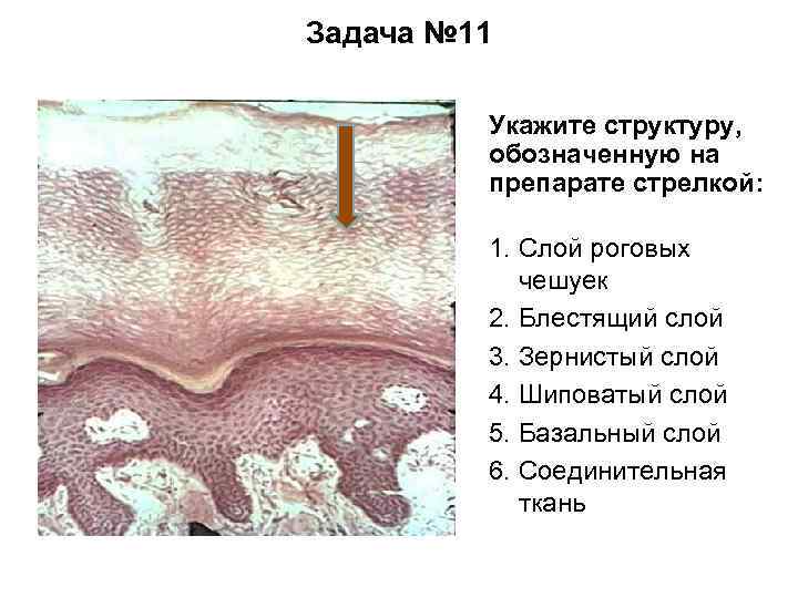 Задача № 11 Укажите структуру, обозначенную на препарате стрелкой: 1. Слой роговых чешуек 2.