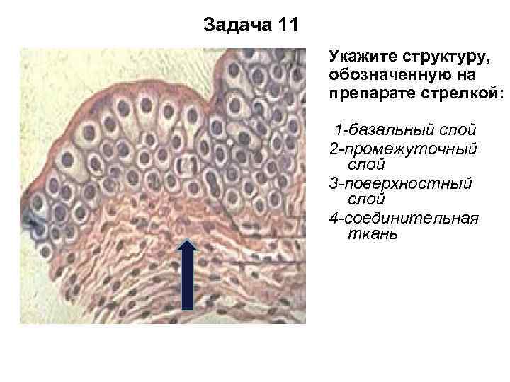 Задача 11 Укажите структуру, обозначенную на препарате стрелкой: 1 -базальный слой 2 -промежуточный слой