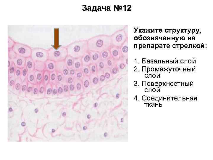Задача № 12 Укажите структуру, обозначенную на препарате стрелкой: 1. Базальный слой 2. Промежуточный