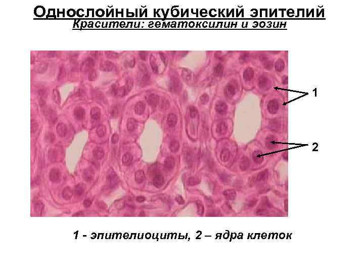 Эпителий плоский повышен