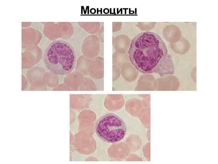 Моноциты 