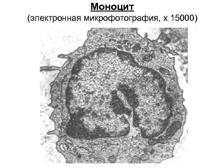 Моноцит (электронная микрофотография, x 15000) 