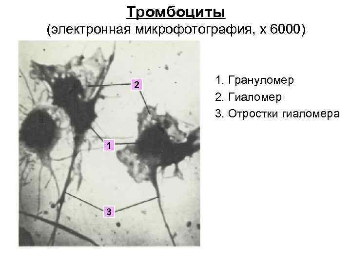 Тромбоциты (электронная микрофотография, x 6000) 2 1 3 1. Грануломер 2. Гиаломер 3. Отростки