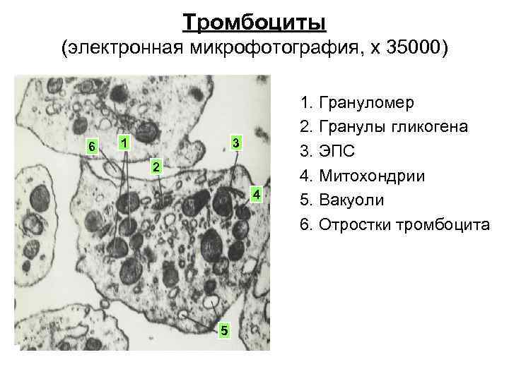 Тромбоциты (электронная микрофотография, x 35000) 6 1 3 2 4 5 1. Грануломер 2.