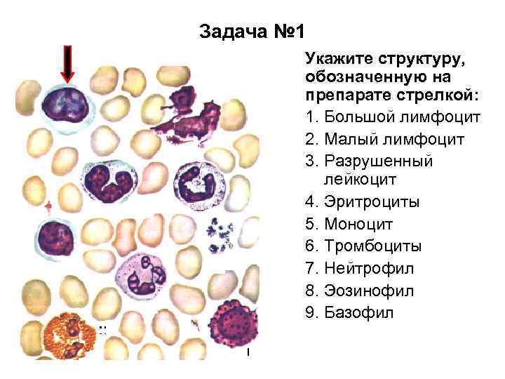 Задача № 1 Укажите структуру, обозначенную на препарате стрелкой: 1. Большой лимфоцит 2. Малый