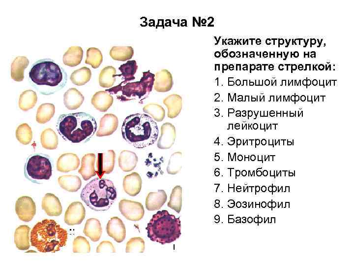 Задача № 2 Укажите структуру, обозначенную на препарате стрелкой: 1. Большой лимфоцит 2. Малый