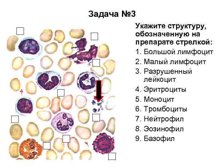 Задача № 3 Укажите структуру, обозначенную на препарате стрелкой: 1. Большой лимфоцит 2. Малый