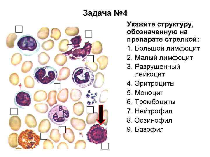 Задача № 4 Укажите структуру, обозначенную на препарате стрелкой: 1. Большой лимфоцит 2. Малый