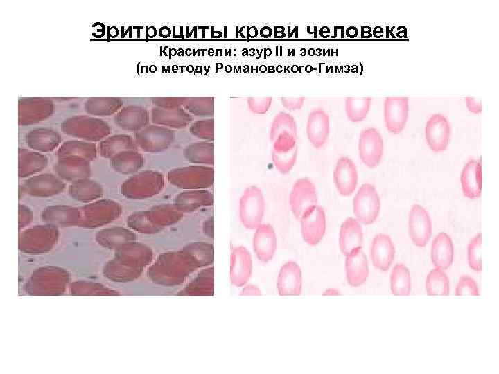 Эритроциты крови человека Красители: азур II и эозин (по методу Романовского-Гимза) 