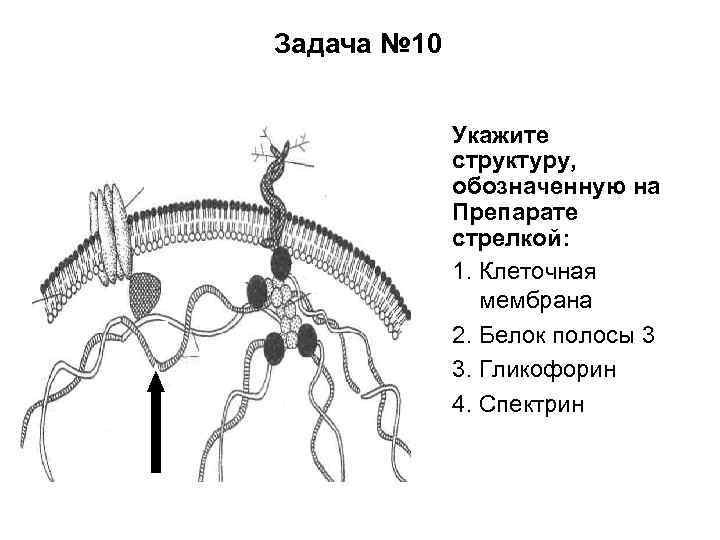 Задача № 10 Укажите структуру, обозначенную на Препарате стрелкой: 1. Клеточная мембрана 2. Белок