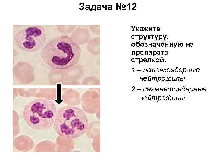 Задача № 12 Укажите структуру, обозначенную на препарате стрелкой: 1 – палочкоядерные нейтрофилы 2