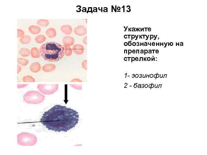 Задача № 13 Укажите структуру, обозначенную на препарате стрелкой: 1 - эозинофил 2 -
