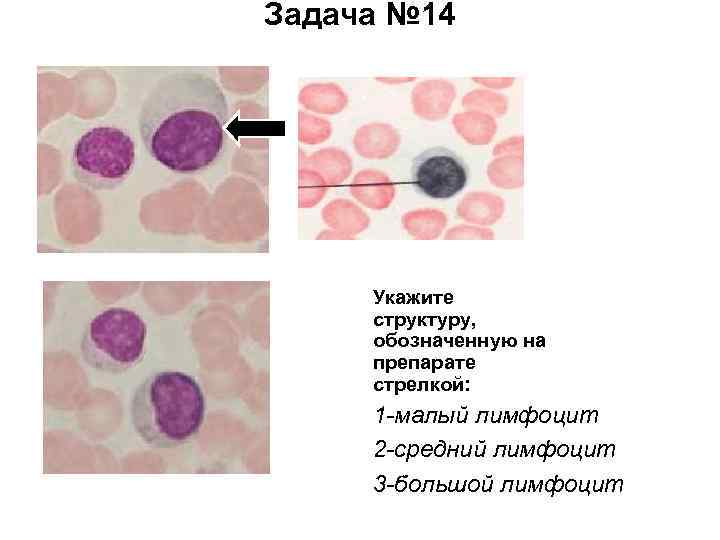 Задача № 14 Укажите структуру, обозначенную на препарате стрелкой: 1 -малый лимфоцит 2 -средний