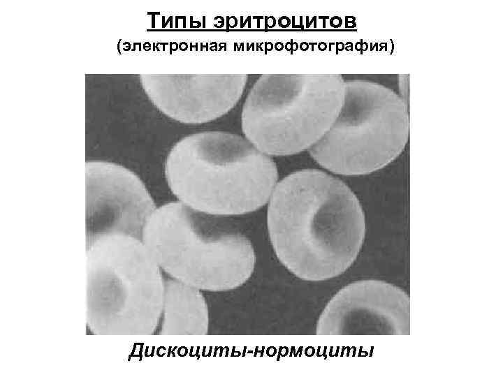 Типы эритроцитов (электронная микрофотография) Дискоциты-нормоциты 