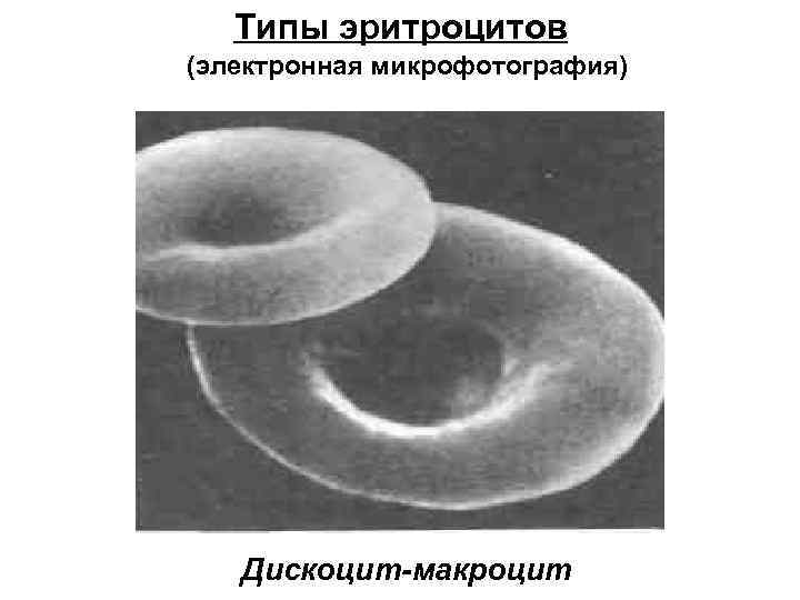 Типы эритроцитов (электронная микрофотография) Дискоцит-макроцит 