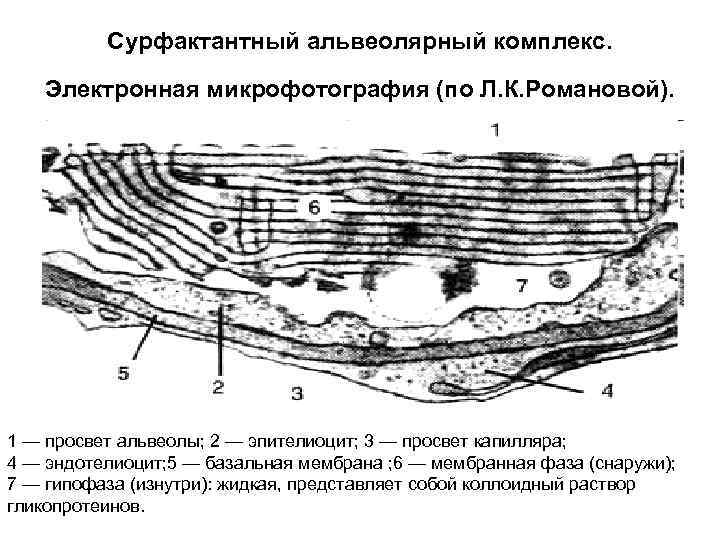 Сурфактантный альвеолярный комплекс. Электронная микрофотография (по Л. К. Романовой). 1 — просвет альвеолы; 2