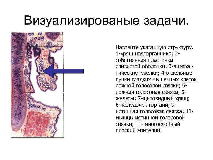 Визуализированые задачи. Назовите указанную структуру. 1 -хрящ надгортанника; 2 собственная пластинка слизистой оболочки; 3