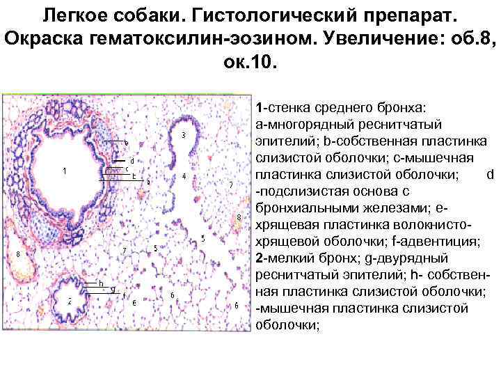 Легкое собаки. Гистологический препарат. Окраска гематоксилин-эозином. Увеличение: об. 8, ок. 10. 1 -стенка среднего