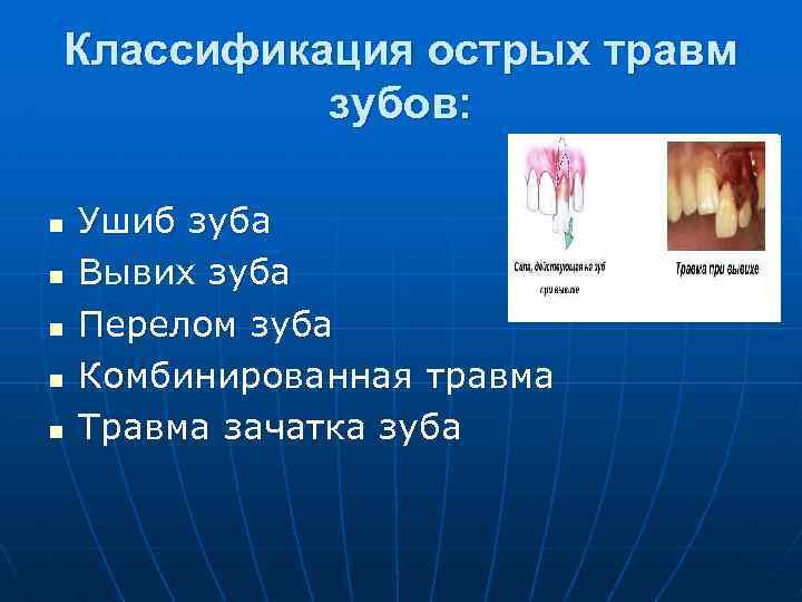Классификация острых травм зубов: n n n Ушиб зуба Вывих зуба Перелом зуба Комбинированная