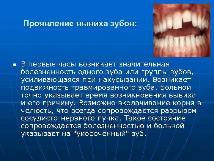 Проявление вывиха зубов: n В первые часы возникает значительная болезненность одного зуба или группы