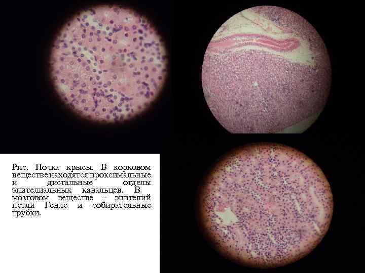 Почка гистология рисунок с подписями