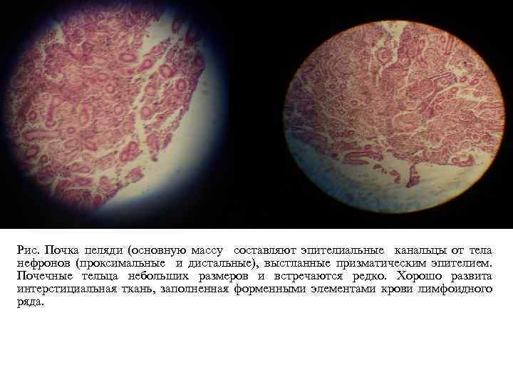 Рис. Почка пеляди (основную массу составляют эпителиальные канальцы от тела нефронов (проксимальные и дистальные),