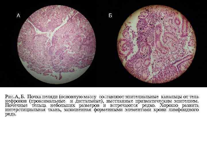 А Б В Рис. Б Рис. А, Б. Почка пеляди (основную массу составляют эпителиальные