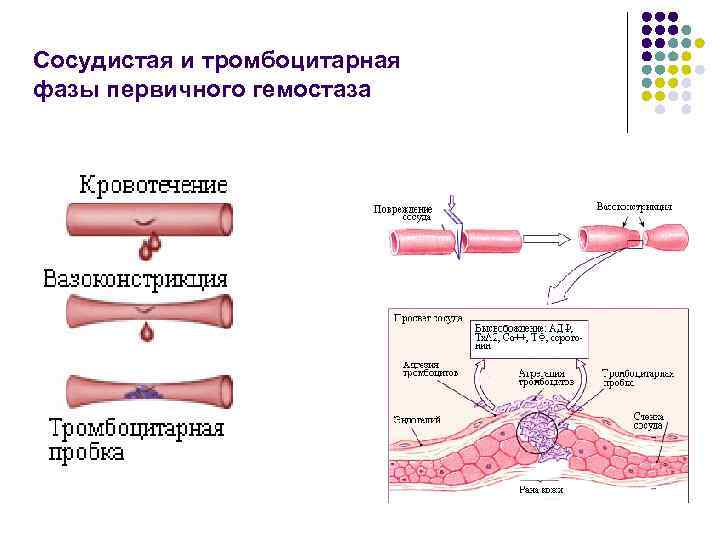 Нарушения сосудисто тромбоцитарного гемостаза