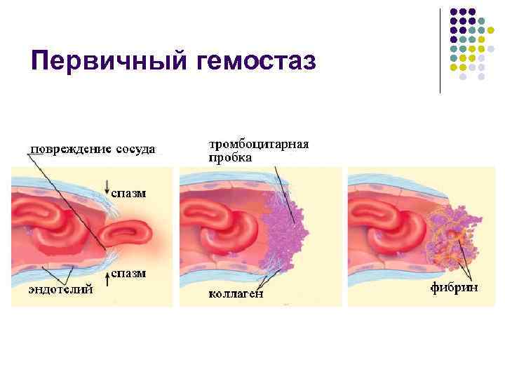 Гемостаз ригевидоном схема