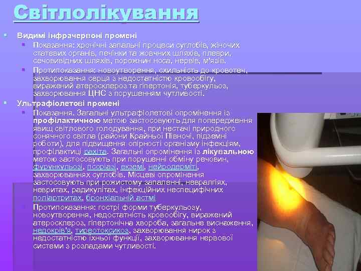 Світлолікування § § Видимі інфрачервоні промені § Показання: хронічні запальні процеси суглобів, жіночих статевих