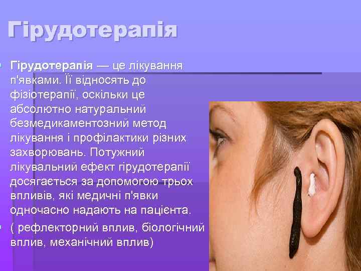 Гірудотерапія § Гірудотерапія — це лікування п'явками. Її відносять до фізіотерапії, оскільки це абсолютно