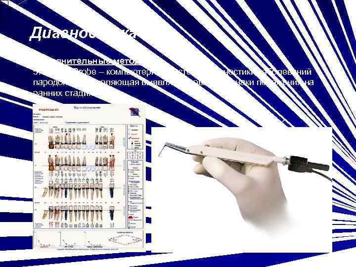 Диагностика Дополнительные методы: 5. Florida Probe – компьютерная система диагностики заболеваний пародонта, позволяющая выявлять