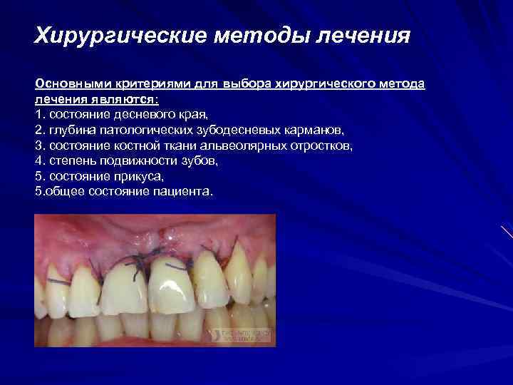 Хирургические методы лечения Основными критериями для выбора хирургического метода лечения являются: 1. состояние десневого