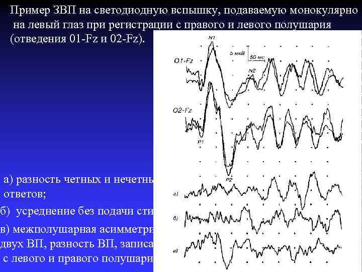 Пример ЗВП на светодиодную вспышку, подаваемую монокулярно на левый глаз при регистрации с правого