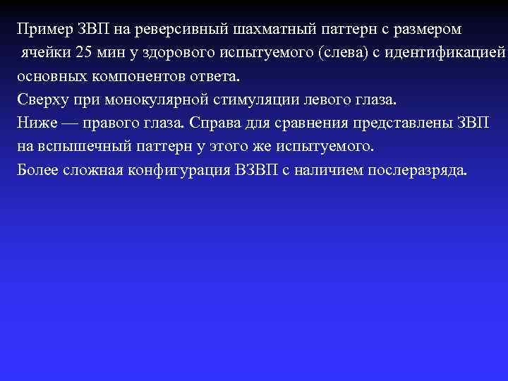 Пример ЗВП на реверсивный шахматный паттерн с размером ячейки 25 мин у здорового испытуемого