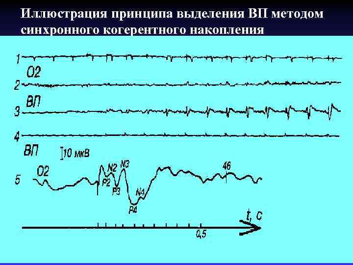 Иллюстрация принципа выделения ВП методом синхронного когерентного накопления 