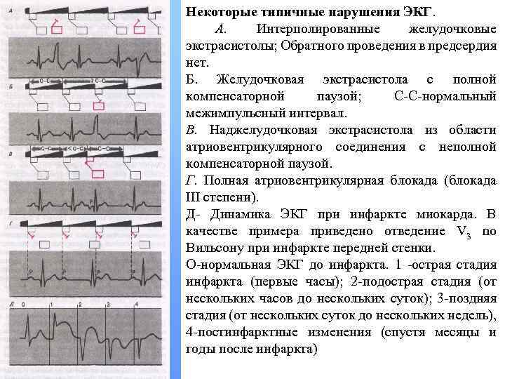 Экстрасистолия карта вызова