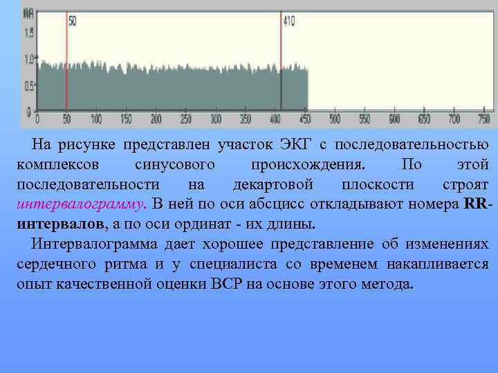 На рисунке представлен участок ЭКГ с последовательностью комплексов синусового происхождения. По этой последовательности на