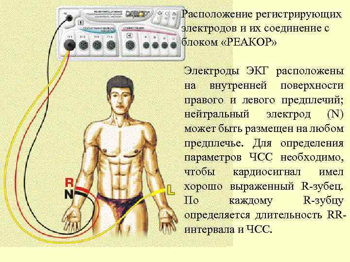 Расположение регистрирующих электродов и их соединение с блоком «РЕАКОР» Электроды ЭКГ расположены на внутренней