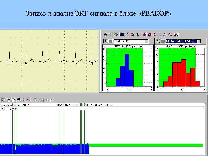 Запись и анализ ЭКГ сигнала в блоке «РЕАКОР» 