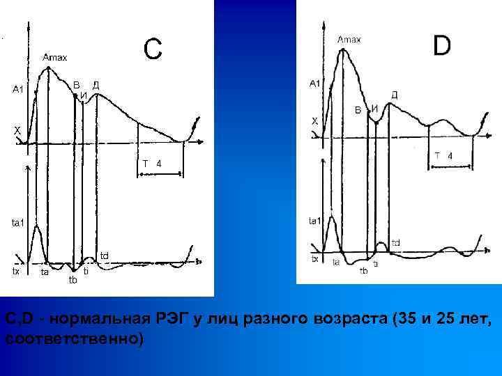 C, D - нормальная РЭГ у лиц разного возраста (35 и 25 лет, соответственно)