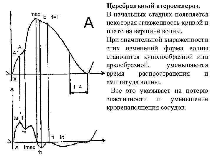 Импедансная диаграмма электрохимической ячейки